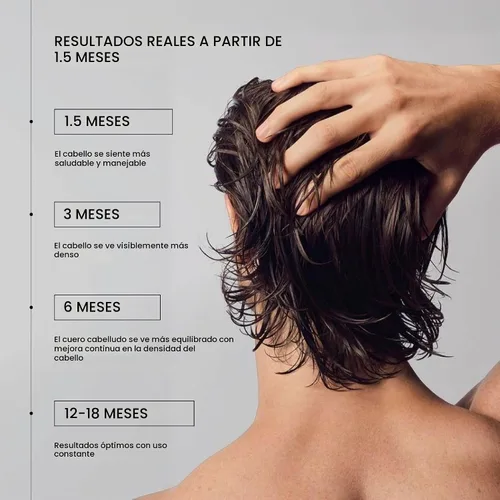 Vista 2 de Zenagen Revolve - Dúo de pérdida de cabello para hombre, 2.5 onzas líquidas