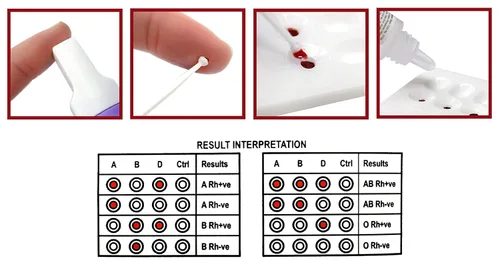 Vista 5 de ALDON Innovating Science ABO/RH Kit de prueba de tipo de sangre - Uso educativo, tarjeta de grupo sanguíneo Erycard, solución tampón, toallita