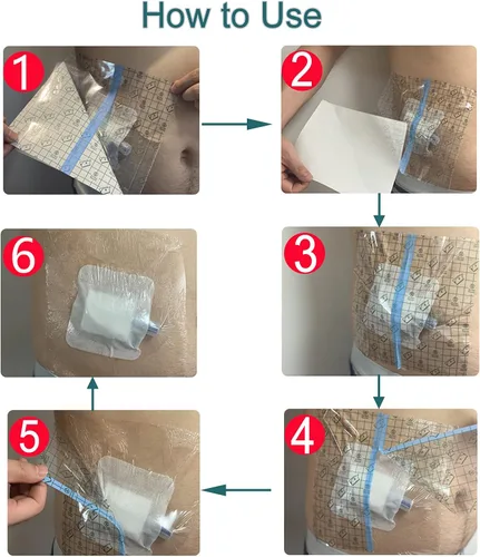 Vista 8 de Ostomy - Funda de ducha impermeable para bolsa de ostomía, protector de ducha, protector de ducha, colostomía, bolsas de baño, vendaje adhesivo