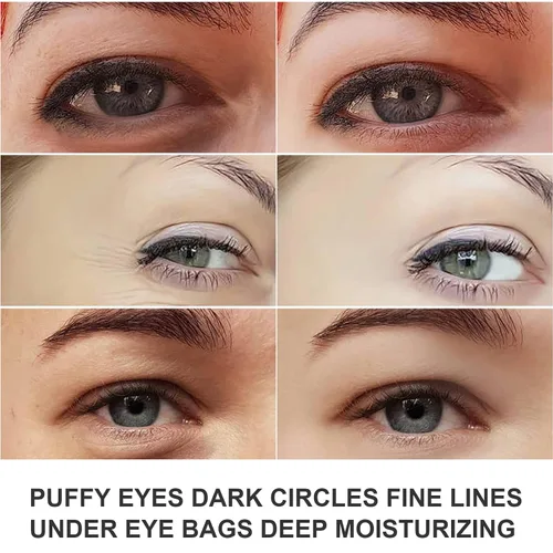 Vista 3 de Máscara de ojos de colágeno rosa, 30 pares de parches de cristal debajo de los ojos para ojos hinchados y ojeras – Parece menos cansado y reduce