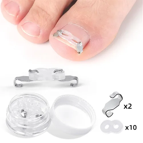 Vista 6 de Juego de herramientas de corrección de uñas encarnadas, 2 clips de inserción de acero inoxidable para tratamiento de uñas encarnadas, tiras