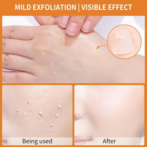 Vista 6 de Gel Exfoliante Naranja, Gel Hidratante y Exfoliante para Cara y Cuerpo, Exfoliante Facial Hidratante Profundo, Gel Natural de Peeling de Naranja