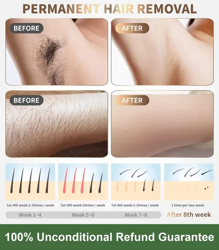 Vista 3 de Dispositivo de depilación láser IPL para mujeres y hombres, reducción permanente sin dolor del 90% del vello en 4 semanas, uso de todo el cuerpo