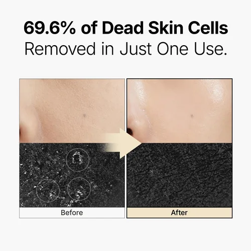 Vista 6 de MANYO Galactomy Enzyme Peeling Gel, Exfoliante Facial y Corporal, Removedor de Piel Muerta, Removedor de Puntos Negros, Gel Exfoliante Coreano