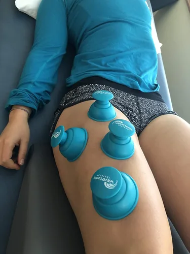 Vista 2 de Riptide" Sport Cupping juego de 4 copas de empuje en estuche de Wavetools Therapy ideal para ventosas dinámicas, dos ventosas fuertes