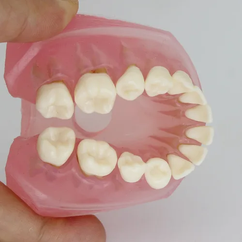 Vista 6 de Modelo de dientes de implante dental con dientes extraíbles para profesionales dentales y estudiantes