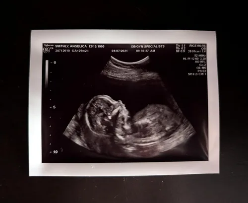 Vista 2 de Broma de ultrasonido falso personalizado 2D, foto única SOLO, SIN género