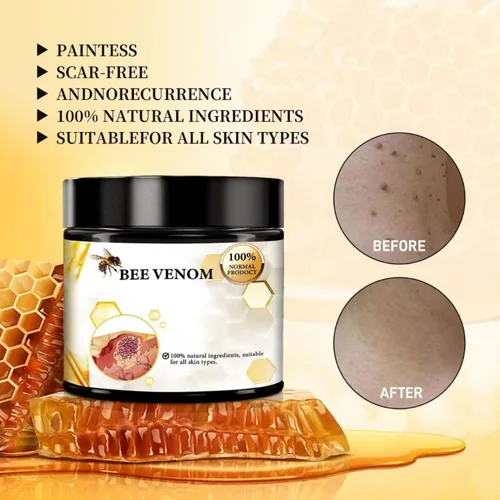 Vista 3 de Bee Venom Cream, nueva crema reparadora de tratamiento de la piel para todas las partes del cuerpo, gel de miel suave profesional para todo