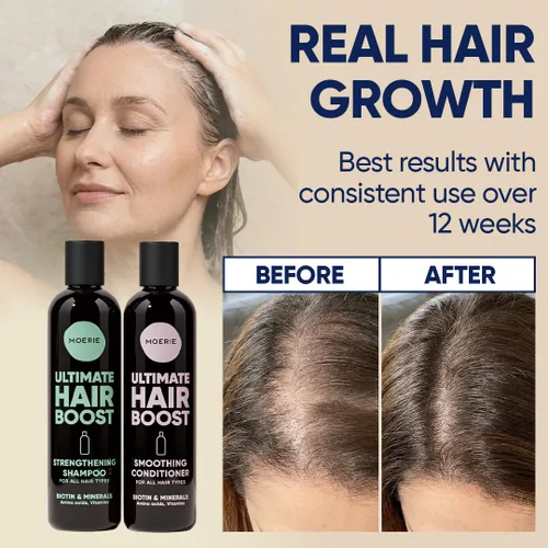 Vista 4 de Moerie Champú y acondicionador voluminizador para la caída del cabello - Productos espesantes con ingredientes de origen natural - Más de 100