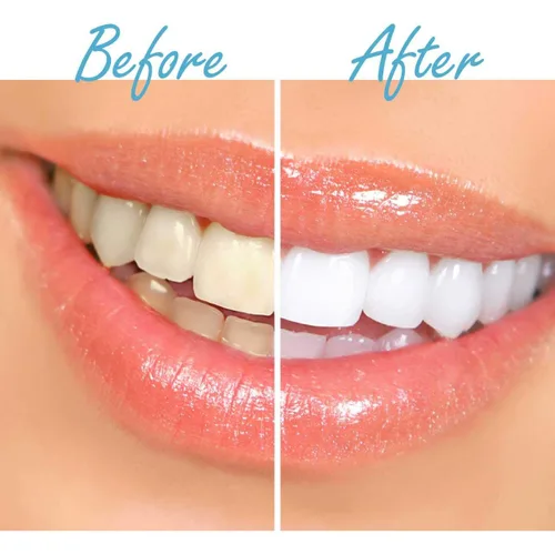 Vista 6 de Pasta de dientes blanqueadora de dientes con carbón de bambú activado DentaPro con sabor a menta