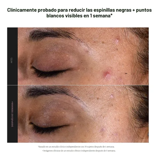 Vista 5 de Paula's Choice SKIN PERFECTING 2% BHA Liquid Exfoliant with Salicylic Acid, Facial Polish for Pores, Wrinkles & Fine Lines, Suitable for