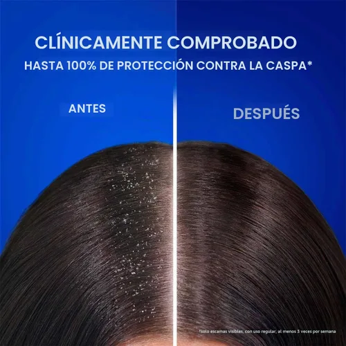 Vista 10 de Head & Shoulders Champú Anticaspa Mentol Fresco para Hombre, 340ml