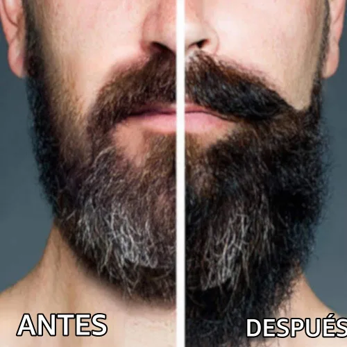 Vista 4 de Arlo's 2 en 1 Pro-Growth - Jabón y acondicionador para barba de 12 onzas con kit de 2 piezas de aceite para barba Pro-Growth