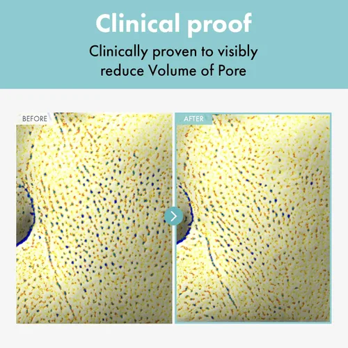 Vista 2 de TOSOWOONG Crema Refinadora de Poros, Minimizador de Poros con AHA - Ácido Glicólico y Ácido Láctico, Hidratante Facial para Control de Grasa