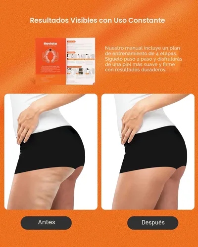 Vista 4 de Herramienta de masaje anticelulítico, removedor ergonómico de celulitis para piernas y brazos con asas desmontables, masajeador de drenaje linfático