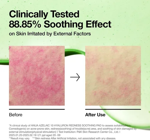 Vista 6 de ANUA Ácido azelaico 10 almohadillas de tóner calmantes de ácido hialurónico, mascarilla facial hidratante para el cuidado de enrojecimiento, poros
