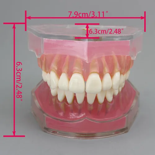 Vista 7 de Modelo de dientes de implante dental con dientes extraíbles para profesionales dentales y estudiantes