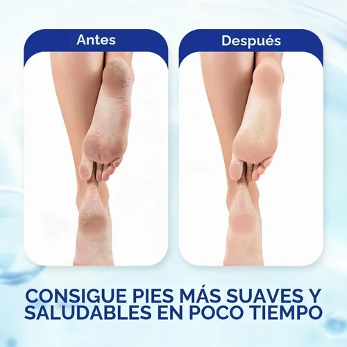 Vista 5 de OUKEYA Crema de urea 42% para secar la piel áspera 5.29 oz, con lima de pie