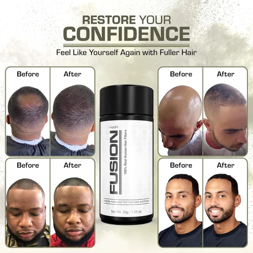 Vista 6 de HAIR FUSION - Fibras de cabello humano 100% reales - Oculta el cabello calvo y adelgazante - Retoque de raíz - Volumizador - Unisex (0.43 oz, Auburn)