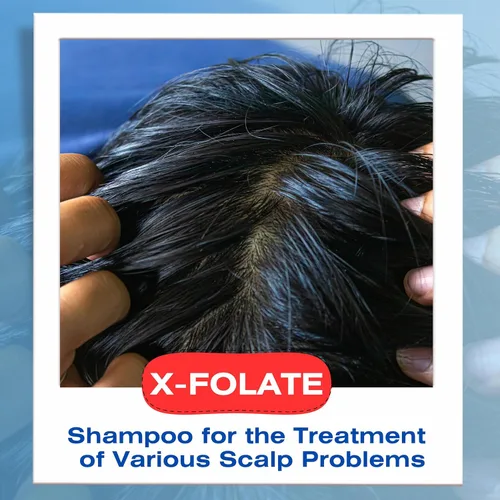 Vista 5 de Mediceuticals X-Folate Shampoo Champú Anticaspa para Mujeres y Hombres – Control Persistente de la Caspa – Para la acumulación de cuero cabelludo