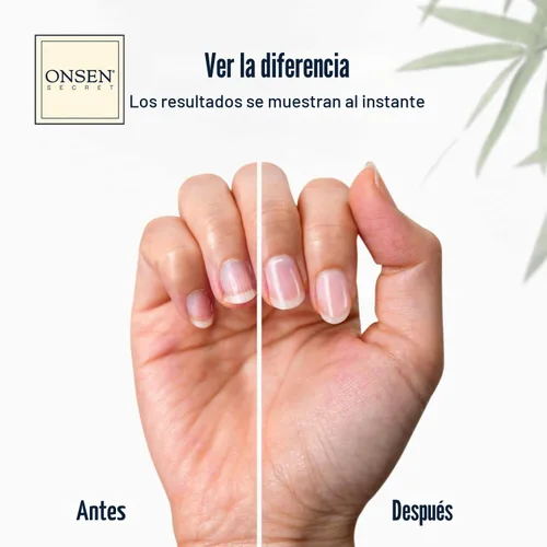 Vista 2 de Onsen Secret Kit de cuidado de uñas, con suero para el cuidado de la cutícula, kit de pulidor de uñas japonés y brillo - fortalecimiento y brillo