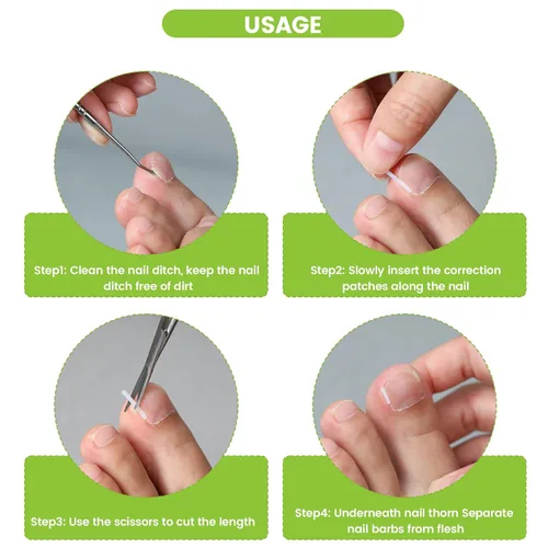 Vista 3 de BEZOX Juego de corrector de uñas encarnadas con cuchilla recta, 40 tiras alisadoras de uñas sin dolor con levantador de uñas de los pies, kit