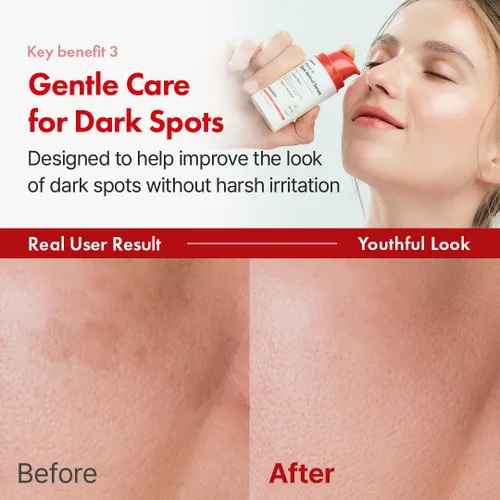 Vista 5 de Hanskin Suero facial de retinol puro 0.1% para cara, reduce las líneas finas y arrugas, signos de envejecimiento para el día y la noche, suavizante