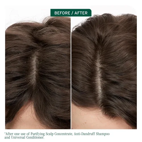 Vista 2 de Biolage Scalp Sync - Concentrado purificador - Tratamiento exfoliante y aclarador del cuero cabelludo seco, refrescante y revitalizante, mezcla