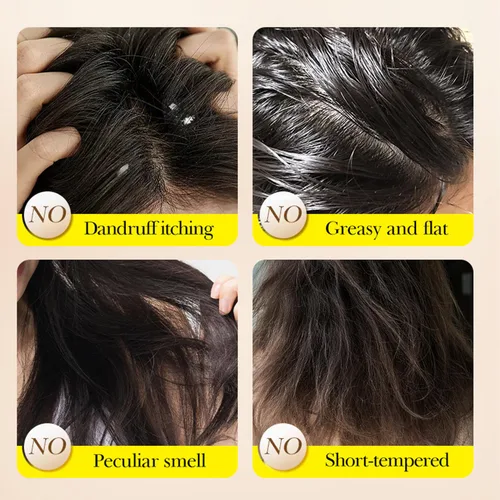Vista 4 de Grospe Barra de champú de aceite esencial de lavanda, limpieza profunda e hidratación, alivia la picazón y la caspa, deja el cabello suave