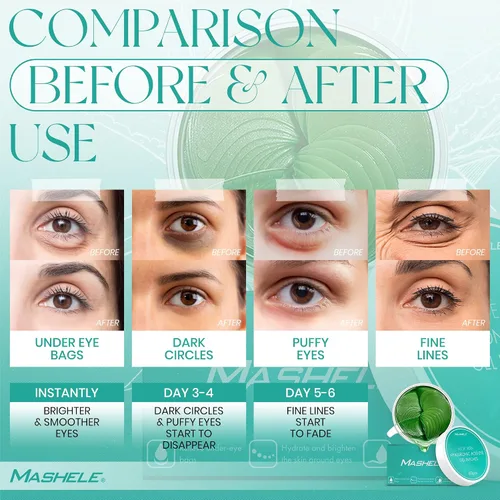 Vista 3 de Máscara de ojos de aloe vera - 60 pares de geles para ojos - Tratamiento para ojos hinchados y ojeras (geles de aloe vera)