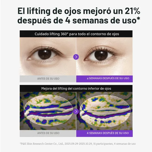 Vista 4 de Centellian24 360 Shot PDRN Crema reafirmante para ojos 1.0 fl oz (1.01 fl oz) – Crema de ojos con retinol antienvejecimiento para ojos con capucha