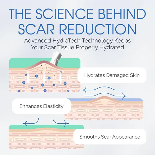 Vista 6 de Suero de gel para cicatrices de silicona 100% – Aplicador de cepillo ultrasuave para procedimientos cosméticos y exfoliaciones faciales, cuidado