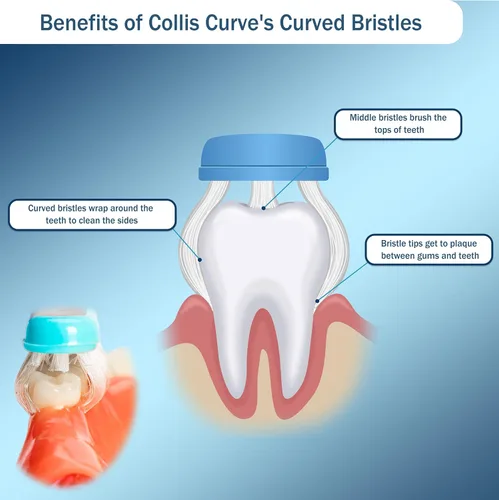 Vista 3 de Collis Curve - Cepillo de dientes suave de 3 caras - Cepillos de dientes de ortodoncia - Cepillo de dientes de cerdas suaves para encías sensibles