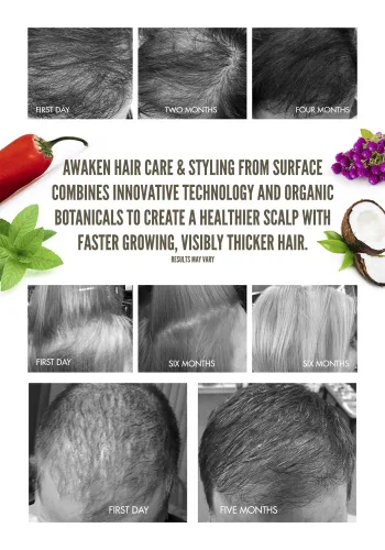 Vista 5 de Máscara terapéutica Surface Hair Awaken