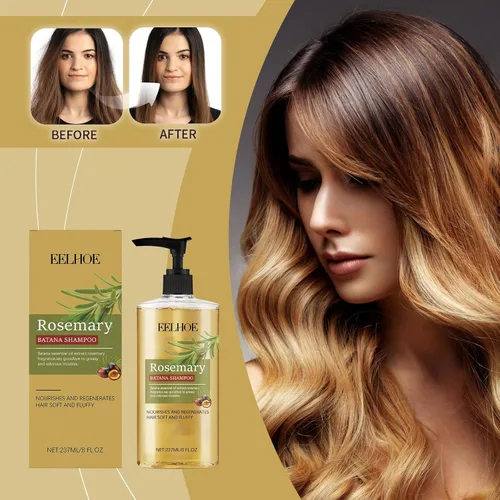 Vista 2 de Batana Oil Hair Shampoo and Romero 8.0 fl oz/8.35fl.oz - promueve el crecimiento del cabello, hidrata, hidrata el cuidado del cabello para mujeres