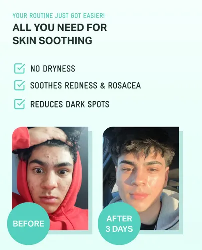 Vista 5 de BRING GREEN ZINC TECA Serum con niacinamida Suero facial calmante para pieles sensibles, minimización de poros e hidratación Cuidado de la piel