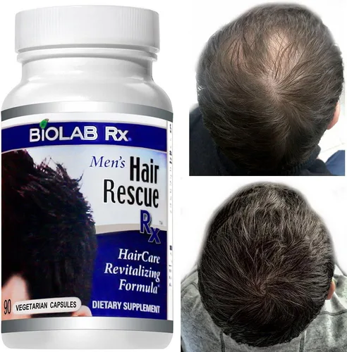 Vista 4 de Hair Rescue Rx - Suplemento para adelgazar el cabello para hombre con biotina y ortiga, soporta un cabello más grueso y saludable, soporte