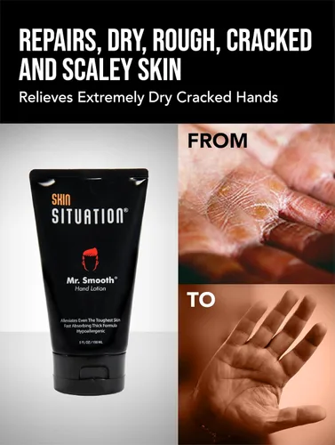 Vista 2 de Mr. Smooth - Loción de manos para hombres Crema curativa gruesa que repara manos ásperas y secas agrietadas y alivio de la piel. Hipoalergénico