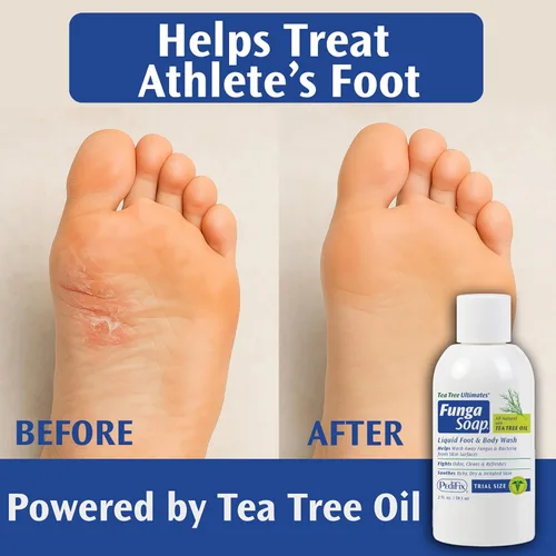 Vista 7 de Pedifix FungaSoap® Jabón de aceite de árbol de té para pies y cuerpo – 2 oz (Tamaño de viaje) – Botella pequeña para cuidado de piel con picazón