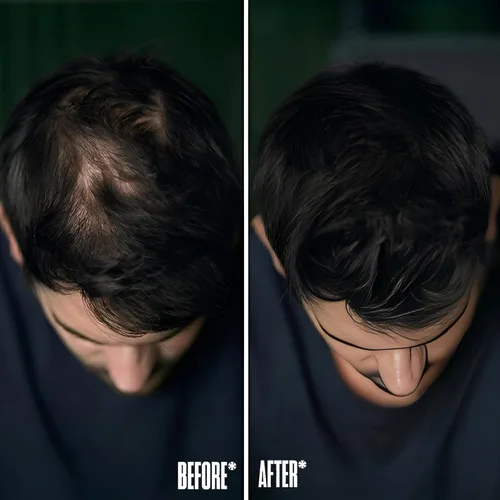 Vista 9 de Polvo de línea capilar para retoque de raíz negra, corrector de pérdida de cabello instantánea para cabello delgado, resistente al viento y al