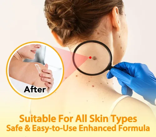 Vista 8 de Bee Venom Cream, nueva crema reparadora de tratamiento de la piel para todas las partes del cuerpo, gel de miel suave profesional para todo