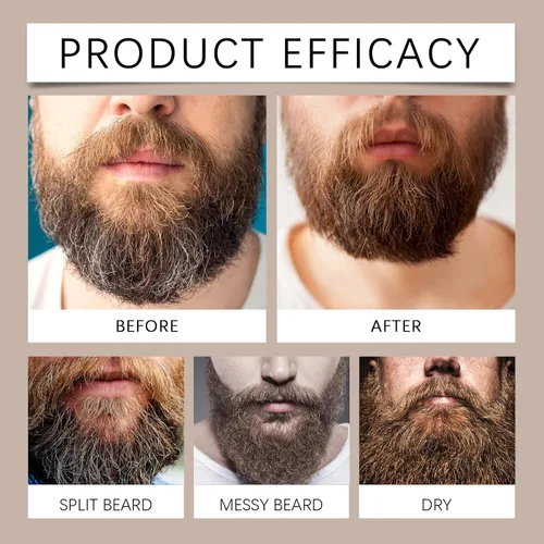 Vista 5 de Cosmetics Para Barba, Bálsamo Estimulante de Barba, Bálsamo Estimulante de Barba Ultra Potente, Crema Para Barba, Hidrata y Fortalece la Barba, 3.5