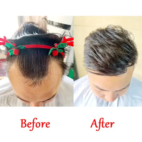 Vista 7 de zigzag hair Tupé de línea capilar para hombre, 0.7 x 6 pulgadas, en forma de V, color negro natural, para hombres, cabello humano real, tupé, piel