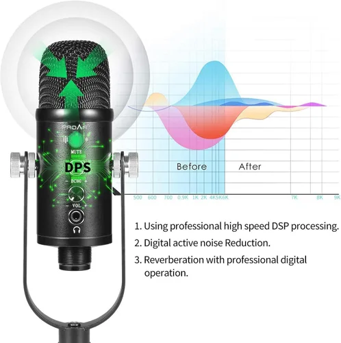 Vista 2 de Micrófono para podcast, kit de micrófono USB para teléfono, PC/Micro/Mac/Android, micrófono profesional de estudio Plug & Play con soporte