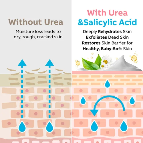 Vista 7 de Adellina Crema de urea 40 por ciento para pies de máxima fuerza, crema de pies de urea para talones secos agrietados, pies, rodillas y codos, loción