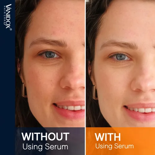 Vista 7 de VANIDOX Suero súper vitamina C para mujeres mayores de 70 años, fórmula todo en uno, fabricado en Estados Unidos, hidrata, reafirma, levanta y se