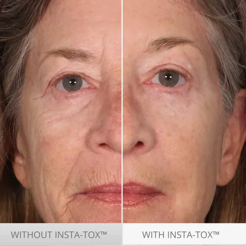Vista 3 de Serious Skincare INSTA-TOX - Suero instantáneo para la piel, suavizante, aprieta temporalmente la cara, reduce instantáneamente la apariencia