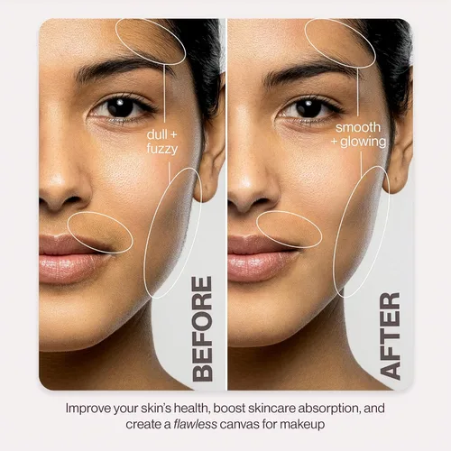 Vista 5 de DERMAFLASH LUXE+ Sonic Dermaplaning Tool for Face Peach Fuzz Removal, Anti-Aging and Exfoliation