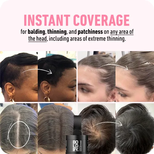 Vista 2 de Boldify Build & Conceal Bundle - Fibra capilar y polvo de línea capilar (rubio oscuro): espesante indetectable para cabello fino, retoque
