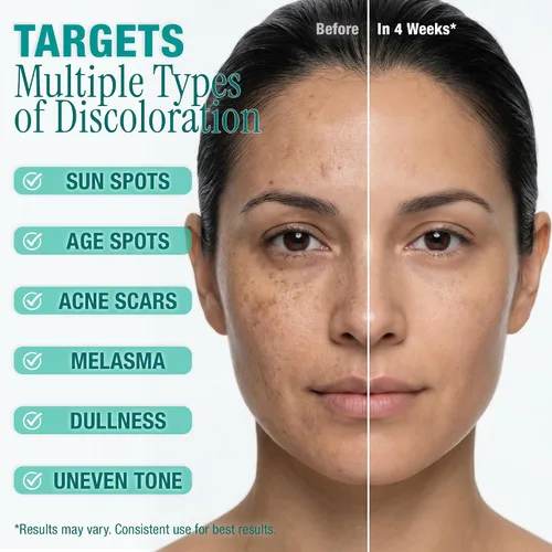 Vista 3 de Ebanel Eliminador de manchas oscuras para rostro y cuerpo, suero iluminador con Synovea HR, alfa arbutina, niacinamida, ácido kójico, corrector